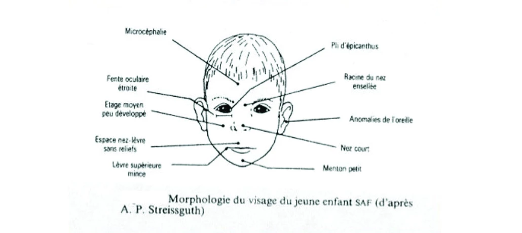 Les malformations faciales